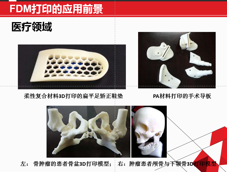 FDM 技術(shù)3D打印機(jī)應(yīng)用領(lǐng)域廣泛，在可預(yù)見的未來無可估量！